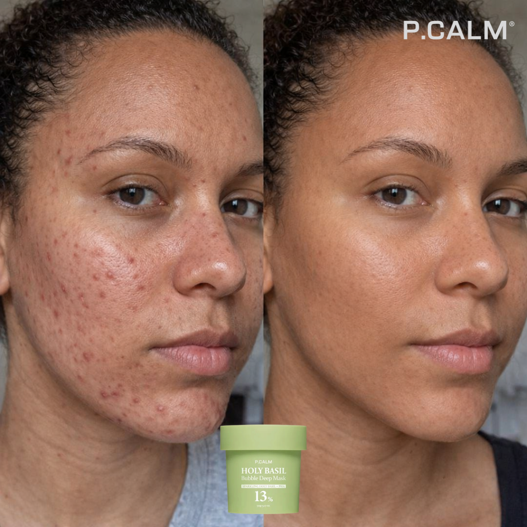 HOLY BASIL - Obtenez un visage propre et sans imperfections en 7 jours