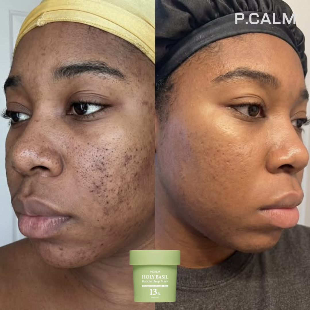 HOLY BASIL - Obtenez un visage propre et sans imperfections en 7 jours