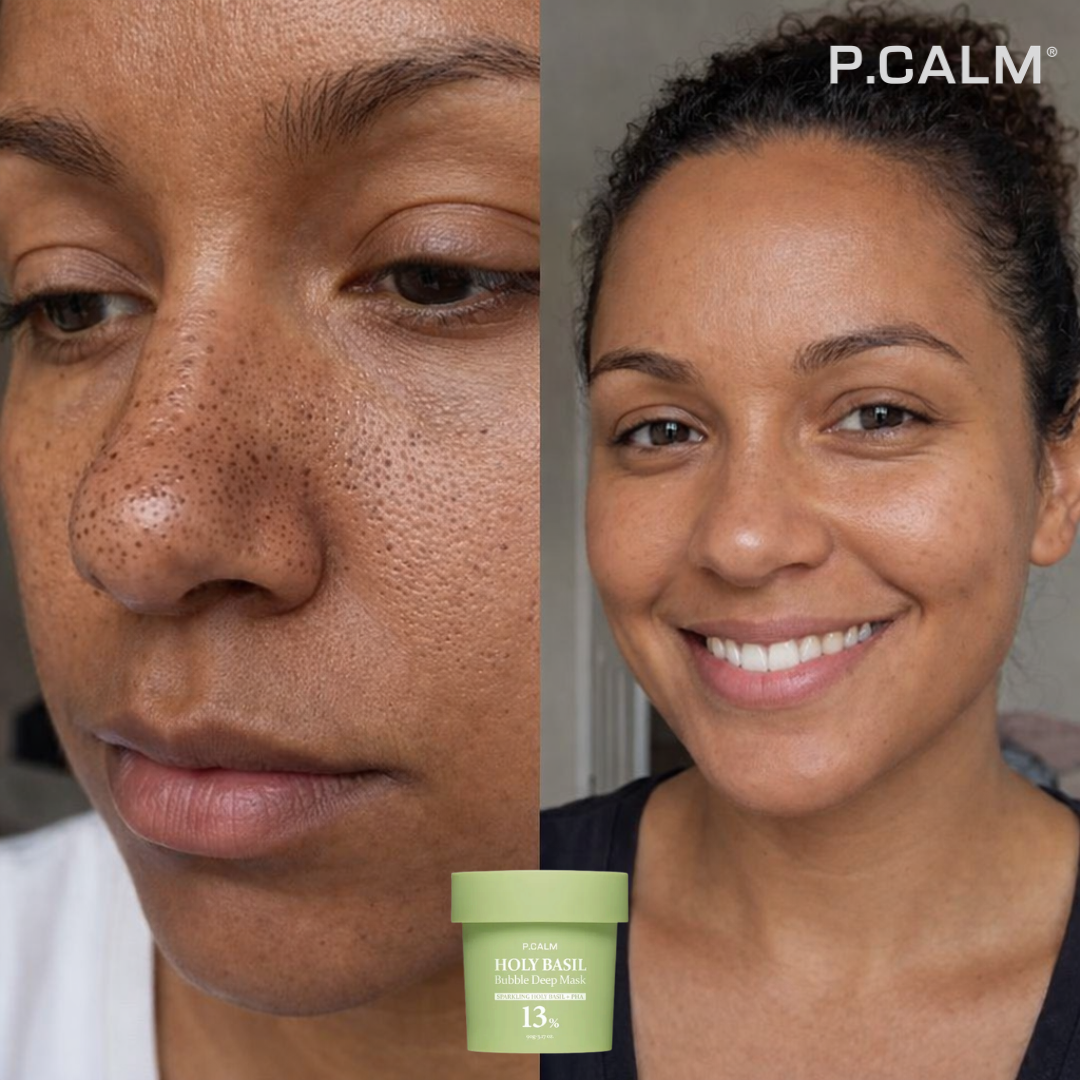 HOLY BASIL - Obtenez un visage propre et sans imperfections en 7 jours