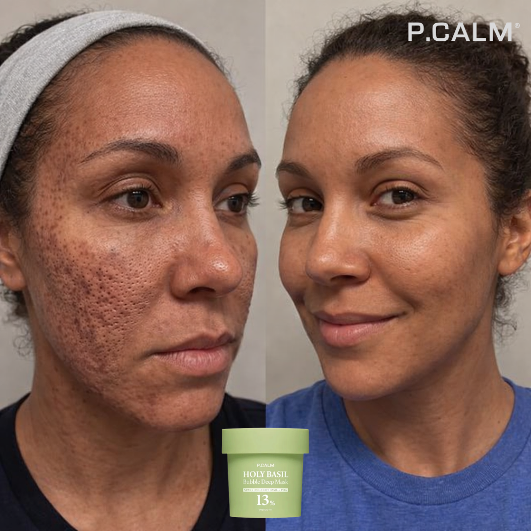 HOLY BASIL - Obtenez un visage propre et sans imperfections en 7 jours