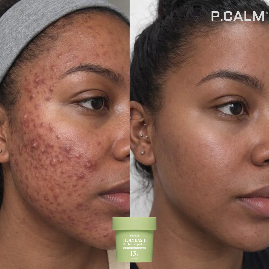 HOLY BASIL - Obtenez un visage propre et sans imperfections en 7 jours