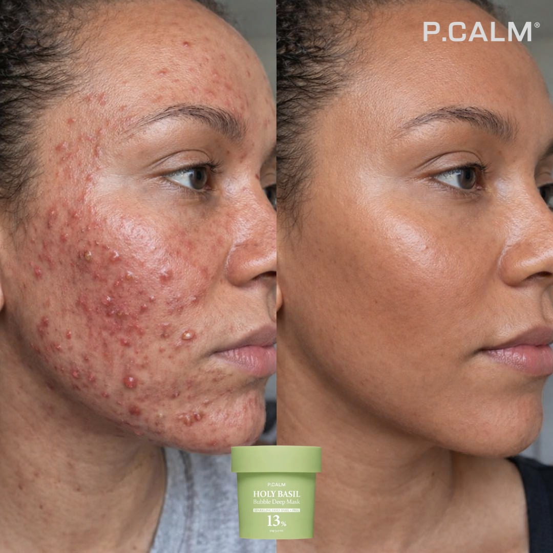 HOLY BASIL - Obtenez un visage propre et sans imperfections en 7 jours