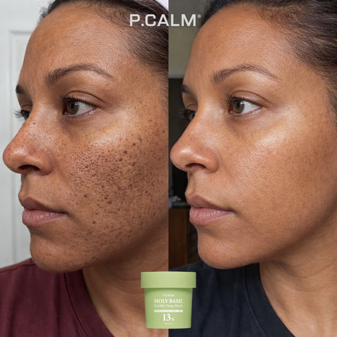 HOLY BASIL - Obtenez un visage propre et sans imperfections en 7 jours