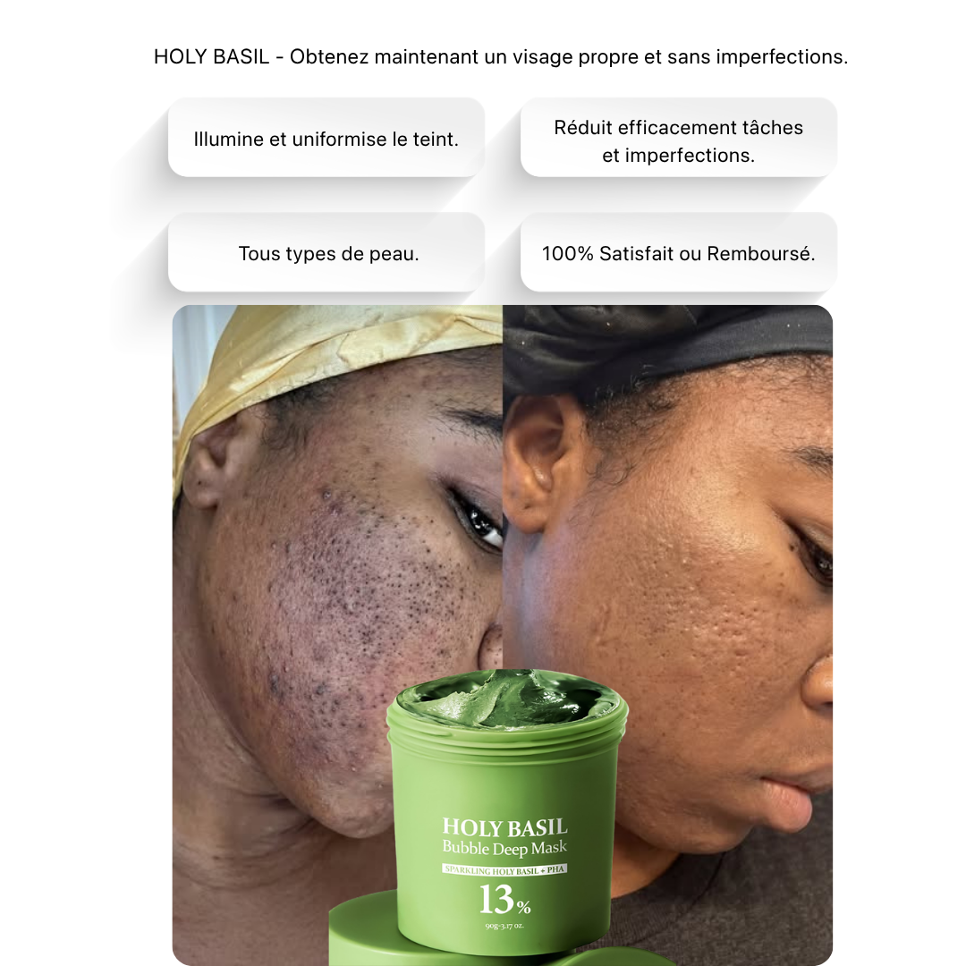 HOLY BASIL - Fini les boutons, taches et imperfections en 7 jours !